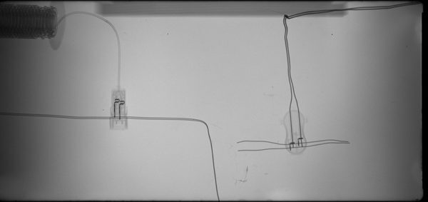 XRay Unit3
